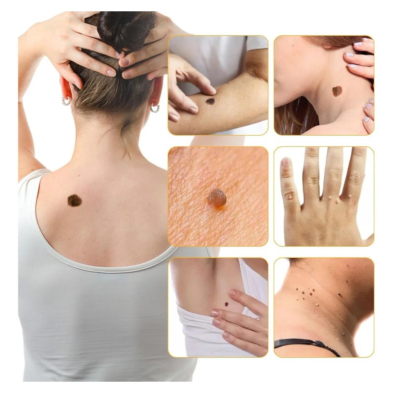 Fsx Crema Para El Cuidado De La Piel, Reduce Todo