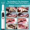 Ultrasonic Dog Teeth Cleaner, Dog Teeth Cleaning, Plaque Remover