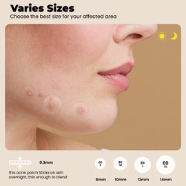 ROSELYNBOUTIQUE Pimples Patches for Face - 300 Counts 4 Sizes Hydrocolloid Acne Patches Fast Absorb