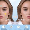 Parches Cuidado Facial Elimina Acné Espinillas Figuras 1016p