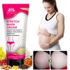 INTIMIFY Stretch Mark Removal Cream For Women, Stretch Mark Cream