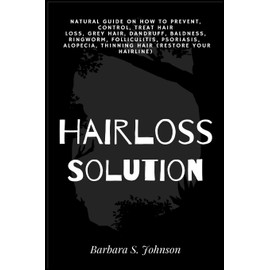 Hairloss Solution: Natural Guide on how to prevent, control, treat hair loss, grey hair, dandruff, baldness, ringworm, folliculitis, psoriasis, ... (restore your hairline) (Adangme Edition)