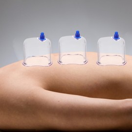 Healifty Vacuum Cupping Device Suction Cups for Body Vacuum Cupping jar Vacuum Suction Vacuum Cup Cupping Accessory Massage Accessories Vacuum Suction Cup Vacuum Tank Household Plastic