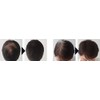 DEXE Hair Building Fiber, Conceals Thinning Hair (Dark Brown)