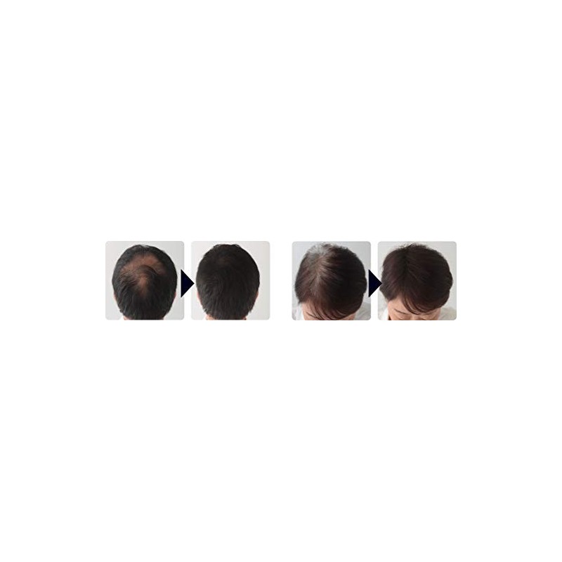 DEXE Hair Building Fiber, Conceals Thinning Hair (Dark Brown)