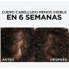 3 Pack Shampoo, Acondic + Serum Aminexil Anticaida Loreal