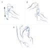 Dove Clinical Expert Antitranspirante en Aerosol 150 ml (la imagen