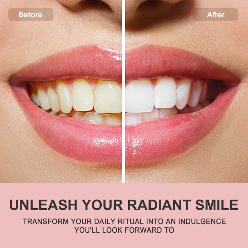 Hotluck Niacinamide Toothpaste | Whitening & Fluoride-Free for Healthy Gums