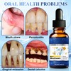 2PCS Beetakt Oral Repair Solution, Mint Flavored Oral Mouthwash，Effectively Improves