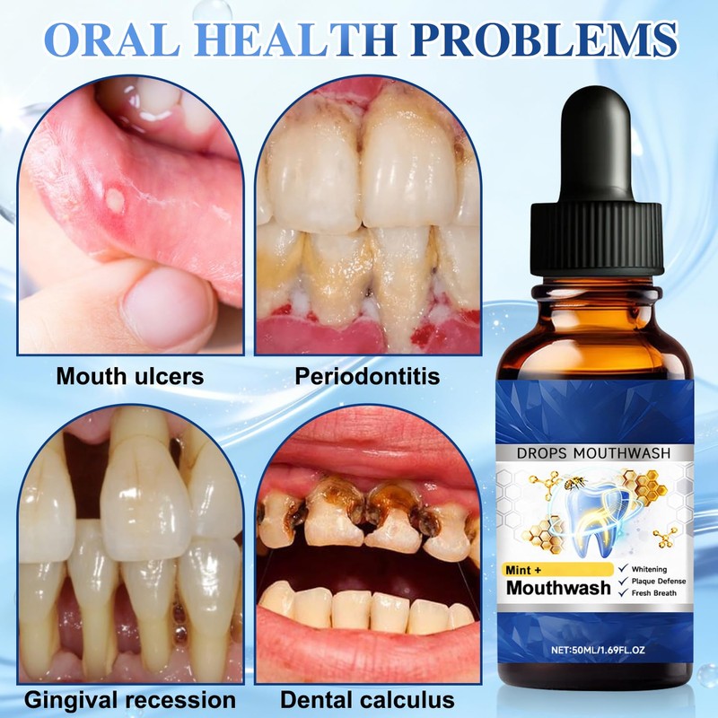 2PCS Beetakt Oral Repair Solution, Mint Flavored Oral Mouthwash，Effectively Improves