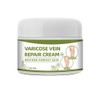 Varicose Veins Cream Natural Ointment for Varicose and Spider Veins
