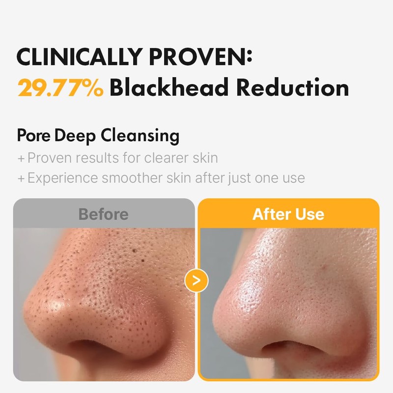 Hanskin PHA Pore Cleansing Oil - Korean Deep Pore Cleansing