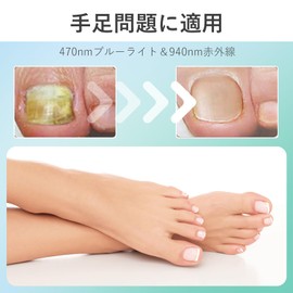 Nail Machine, Nail Care, Foot Care, Nail Cleaning Device, 470 & 905 nm, Blue Light Light, Auto Off After 7 Minutes, Foot Care, Nail Care, Portable Nails, Hand Care, Foot Care, Home Use, Gift, Present