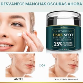 CITYGOO - Eliminador de manchas oscuras para el rostro y cuerpo: crema correctora de manchas oscuras con ingredientes naturales y efectivos para una p