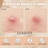 240pzs Mascarillas Estrella Para El Acne Espinillas Granos