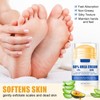 Urea 60% Foot Cream Stick - 40 g Callus Remover