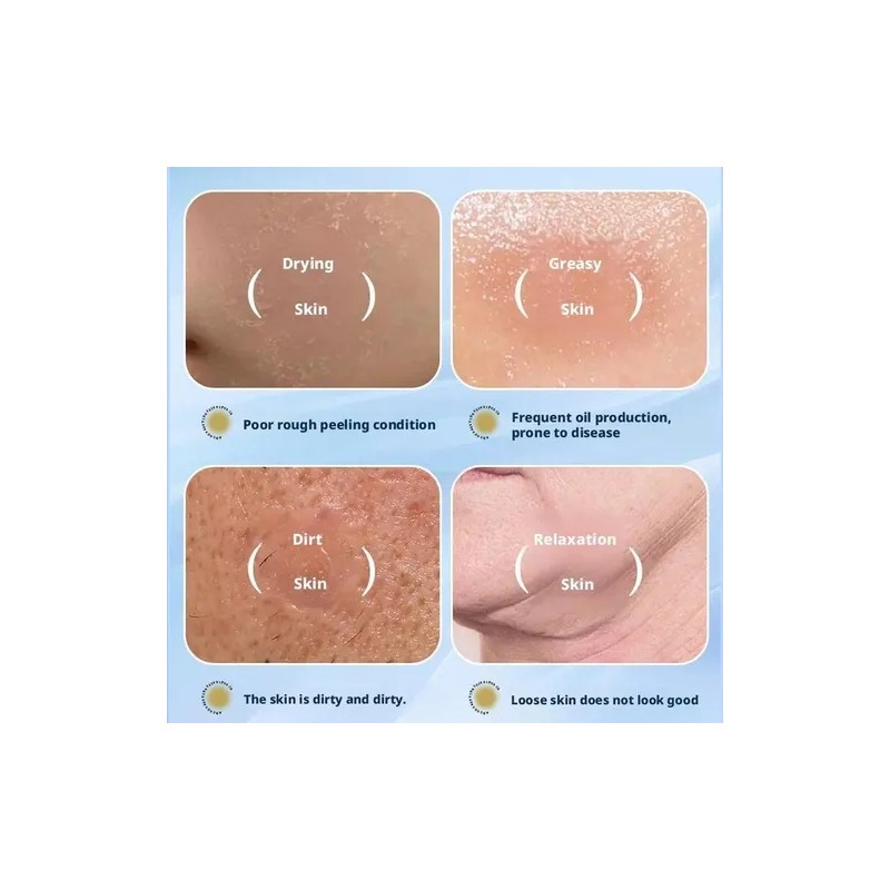 5pcs Nourishment Facial Mask Skincare Cartoon Design