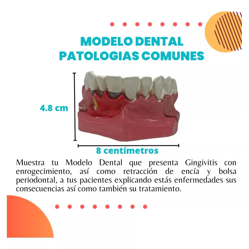 Den Med Modelo Dental Gingivitis