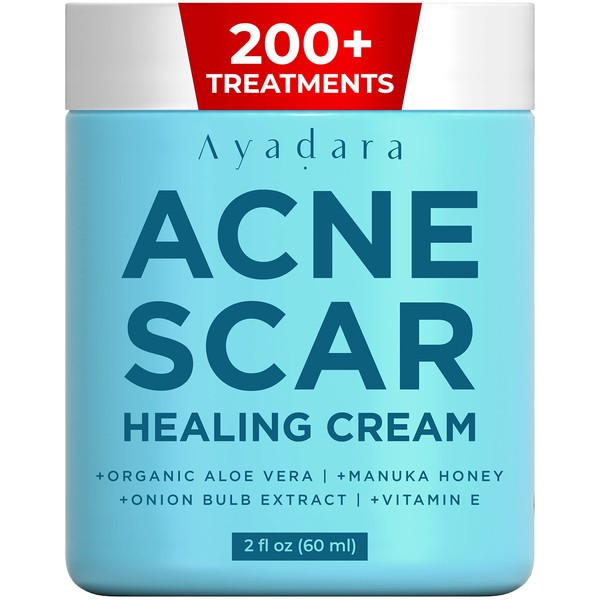 Ayadara Acne Scar Healing Cream, 2 fl oz, Acne Scar Treatment for Face, Stretch Marks, Body Scars, Acne Scar Removal Cream for Body, Acne Scar Remover for Cuts and Burns, For All Skin Types, 200+ Uses