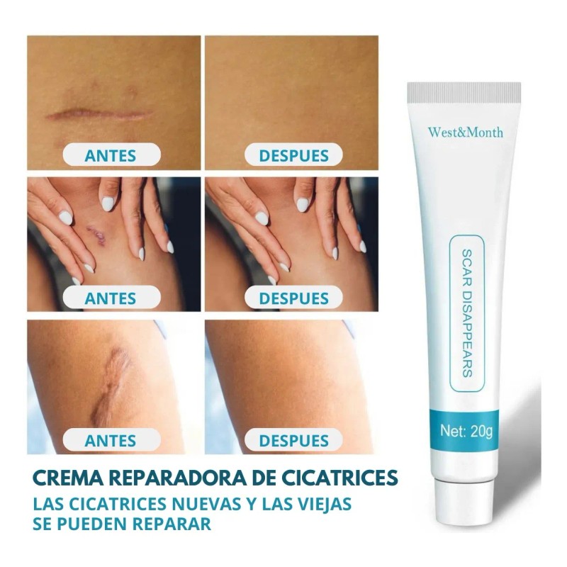 Crema Despigmentatnte Manchas Cicatrices Paño