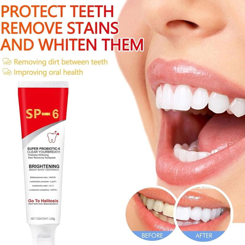 Toothpaste White Teeth, Sp-6 Probiotics Bright White Toothpaste, Ultra Whitening
