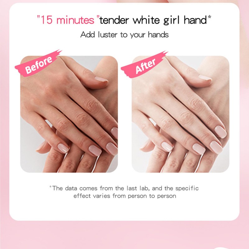 Handmaske 4 Paar Handpflege Handschuhe, Peeling-Handmasken Für Sehr Trockene Hände,