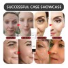 Crema Facial Reparadora Coreana Reafirmante .awdas