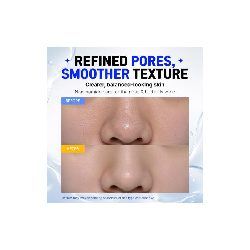 CELDYQUE- 𝙄𝙉𝙏𝙀𝙉𝙎𝙀 20% 𝙉𝙄𝙉𝙼𝙈𝙄𝙉𝙀𝙎: Fortalece la barrera cutánea, reduce visiblemente