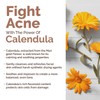 Richfeel Schöne Natürlich Calendula Seife für normale bis Unreine Haut