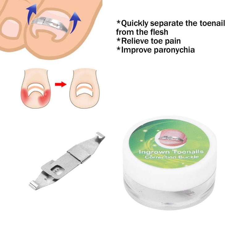1pc Silver Ingrown Toenail Correction 17 to 22mm Adjustable Stainless