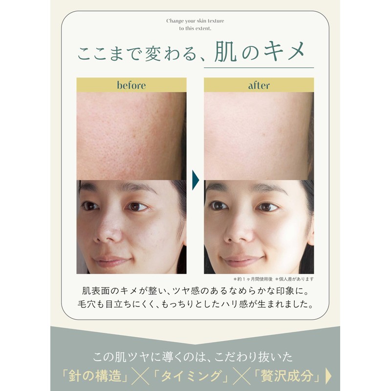 NOWL ニードルデュアルセラム 30ml 美容液 保湿 ハリ 2層構造 レチノール ヒアルロン酸 エクソソーム