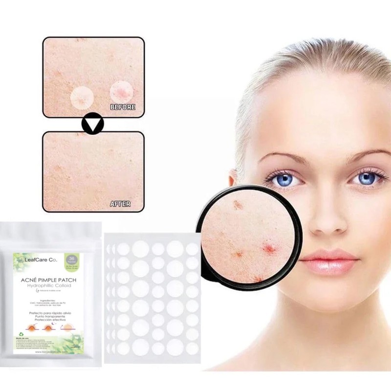 Leafcare Co. 2 pack con 36 pzs, Patch anti acne,