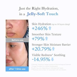 medicube Jelly Cream with Hyaluronic Acid | Daily Moisturizer for All Skin Types | Long-lasting Hydration with Hyaluronic Acid, Ceramides, Multi Pepti