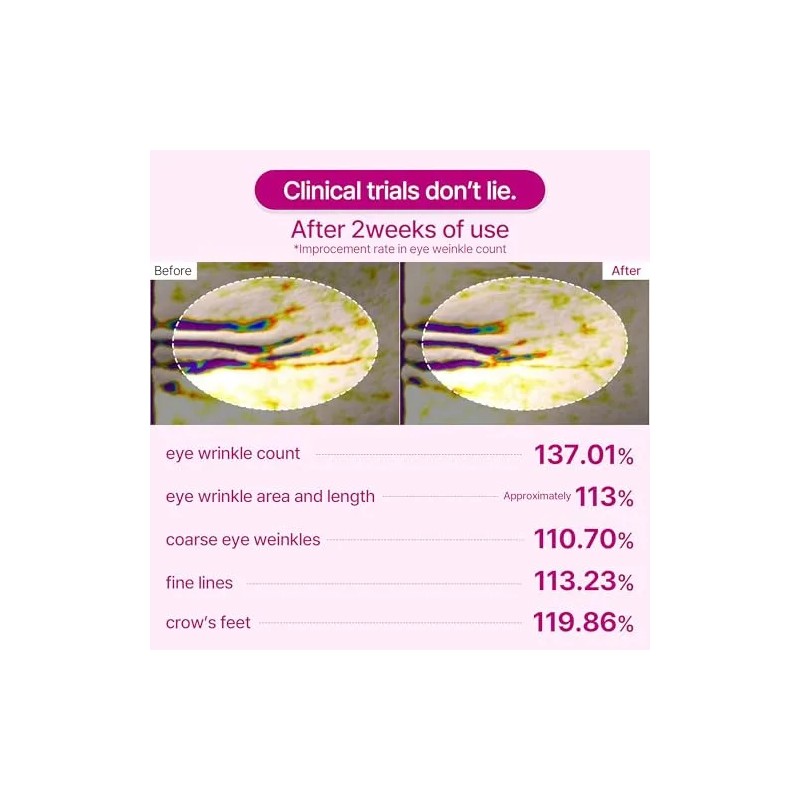2 Paquetes De Parches Cemenrete Calcium Volume Eye 60