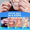 TeethBliss TeethBliss Teeth Whitening Strips: 28Pcs Whitening Strips, Enamel Safe,