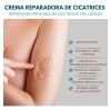 Crema Despigmentatnte Manchas Cicatrices Paño