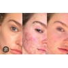 Gel Sabila 99% Facial Aclarante Cicatriz Cara Y Cuerpo Normal