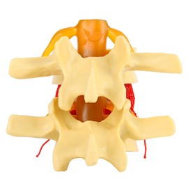 1:1.5 Anatomical Medical Human Spine Lumbar Disc Herniation Demonstration Model for Study Learn