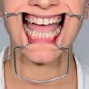 Orringer Self Retaining Cheek Retractor Stainless Steel 17-617