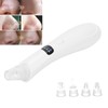 Blackhead Pore Vacuum Cleaner Electric Face Nose Acne Whitehead Extractor