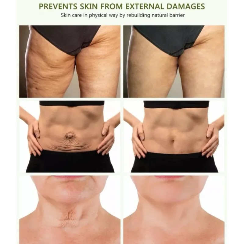 Gel Crema Abdominal Reducir Abdomen Panza Celulitis Tallas Hierbas