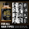 Vitaminas Para El Crecimiento Del Cabello Y La Barba Para