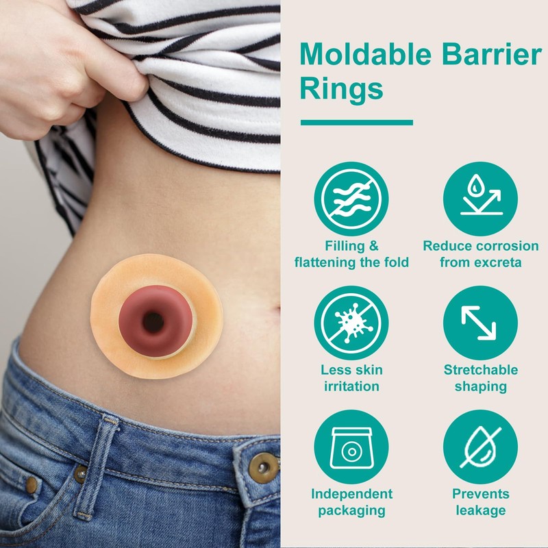 Ostomy Barrier Rings - Outer Diameter 2" (50mm) 4mm Thickness,Moldable