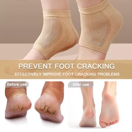 2 Pairs Gel Heel Socks, Heel Protectors Gel Ankle Compression Support Socks for Women Men - Two Colors heel socks for Plantar Fasciitis Cracked Heels Achilles Tendonitis Foot Blister Prevention