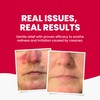 Grahams Natural Anti Redness Face Wash for Rosacea - Facial