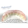 Professional Cosmetic Upper - New from Instant Smile! Hand Crafted