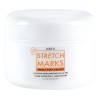 Crema Para Estrías