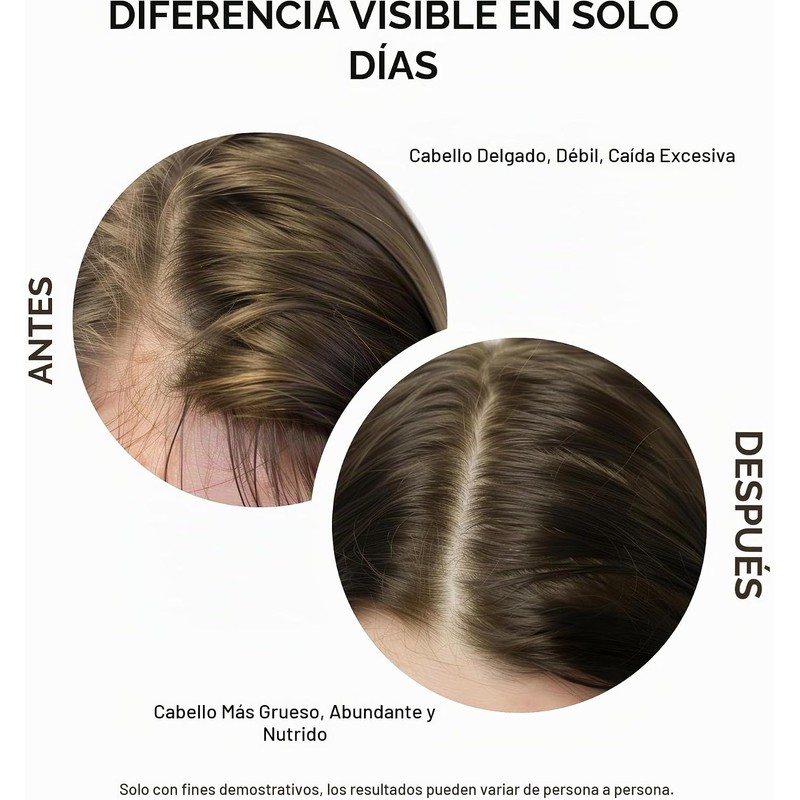 Sérum capilar Masofta para el crecimiento del cabello. Promueve el