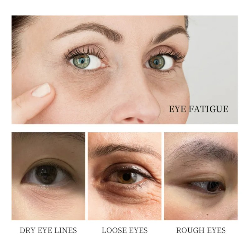 Parches Para Ojos Ojeras Colágeno Oro Arrugas 100 Pares Mask