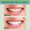 Teeth Whitening White Stripes Teeth, 28 Strips Teeth Whitening -